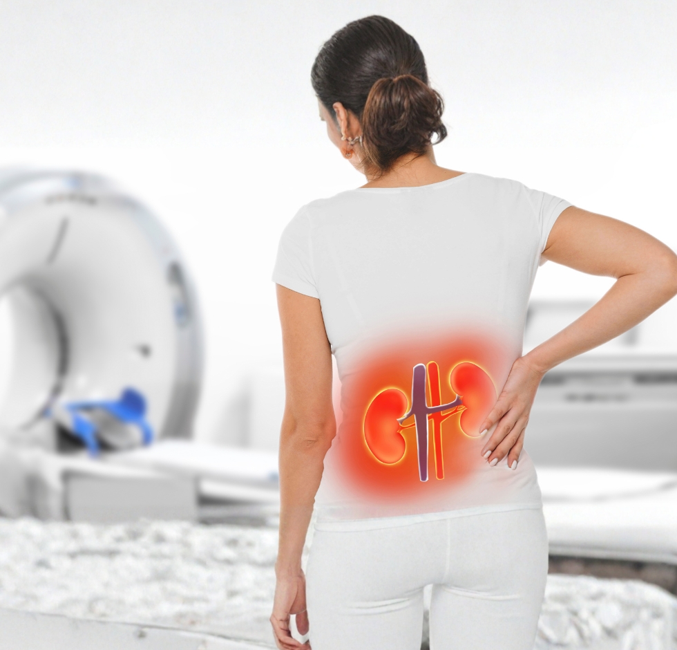 Avances en el tratamiento para enfermedad renal crónica